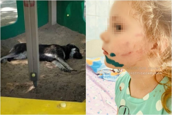 СМИ: В Оренбурге бродячая собака напала на 5-летнюю девочку. Ребенку зашивали щеку